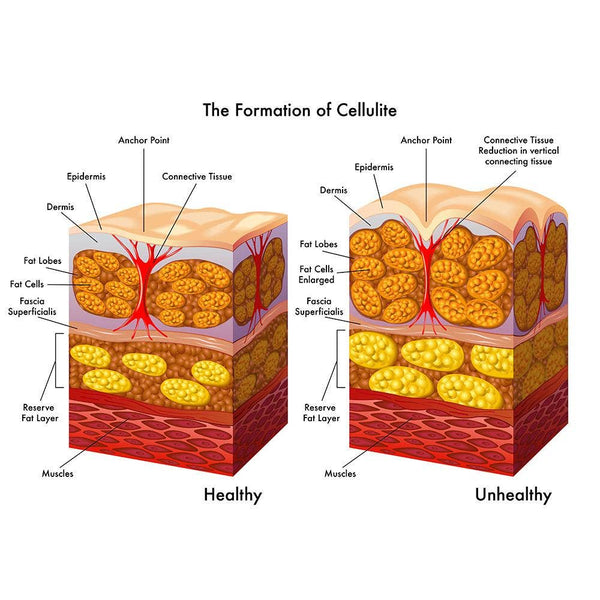 Rollga | Cellulite Reduction Fascial Release Tool